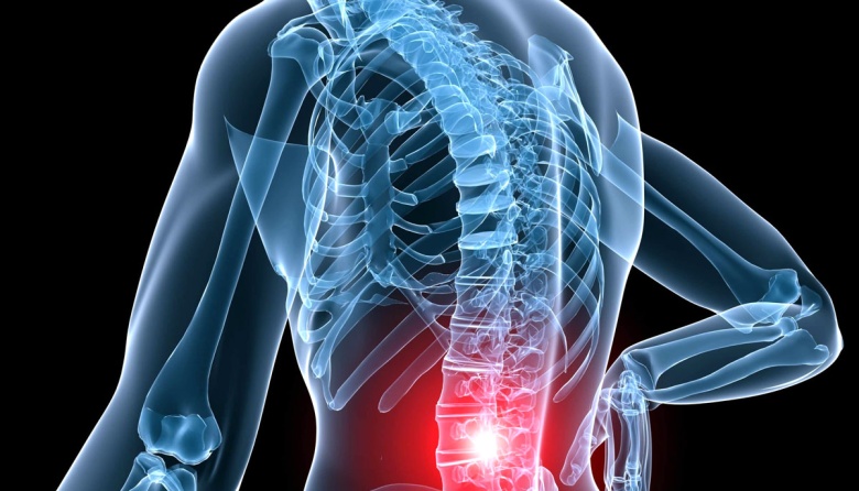 El dolor de espalda persistente podría ser parte de una enfermedad reumatológica